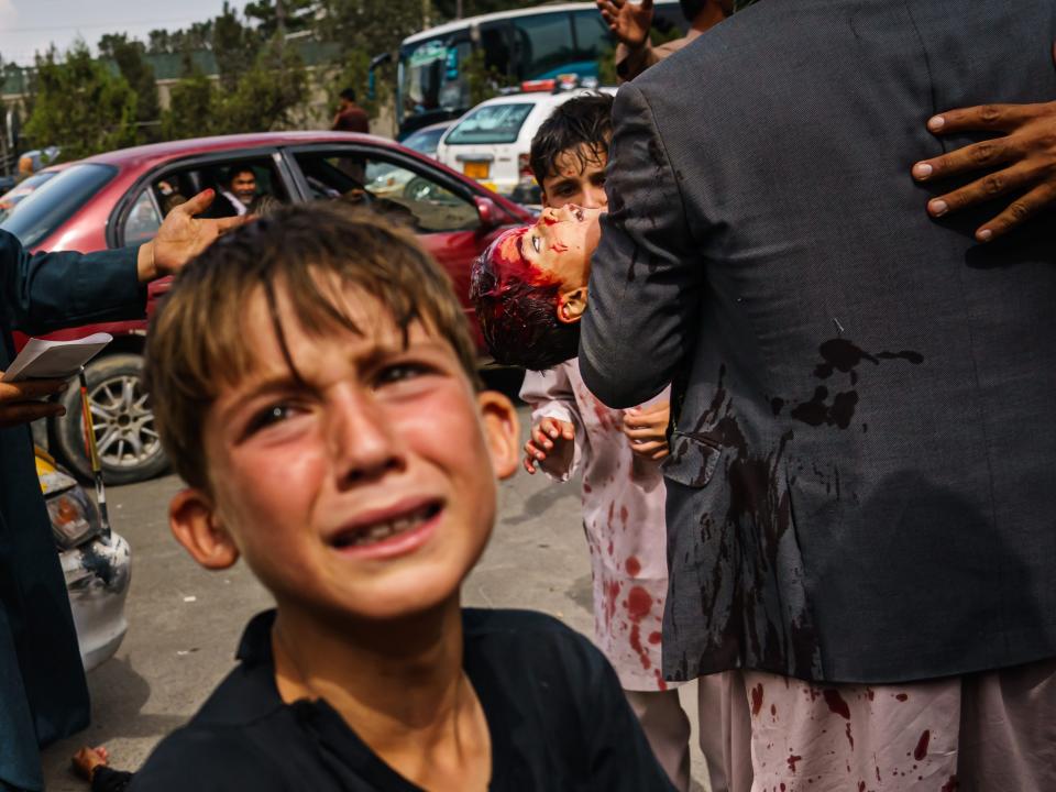 A man carries a bloodied child, as a woman lays wounded on the street in Kabul, Afghanistan.