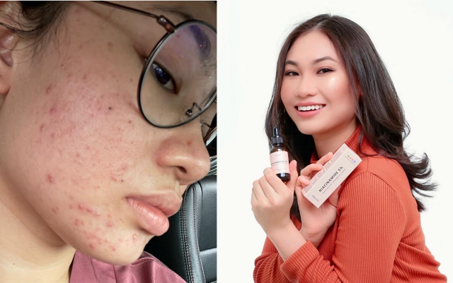 The Raw. Brings Real-Time Skincare Consultation to Malaysians on Shopee Live