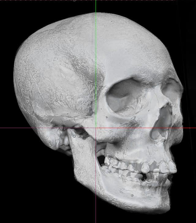 A 3D skull before digital reconstruction of an 18th-century 