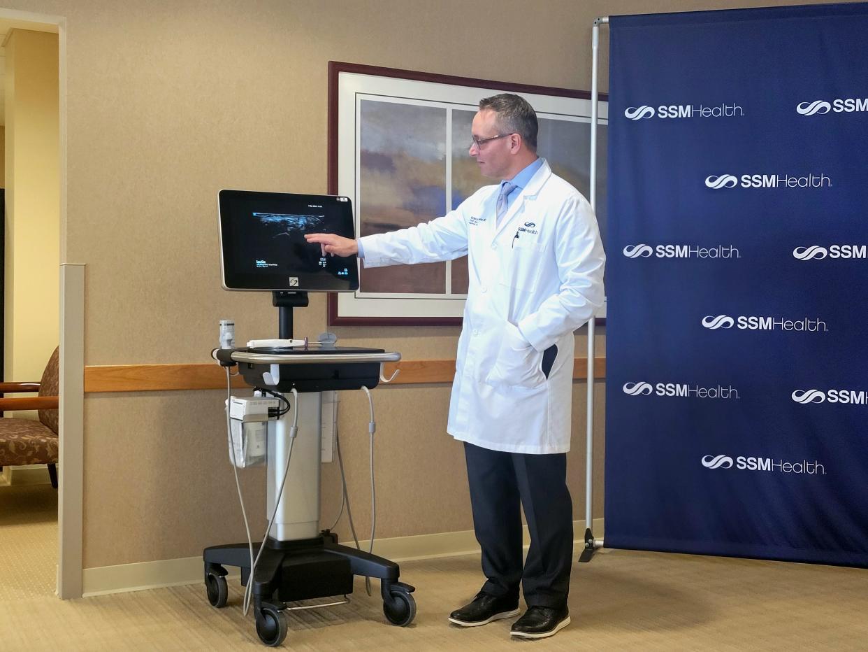 SSM Health Fond du Lac Regional Clinic plastic surgeon Richard Schaefer recently treated his 1000th patient for carpal tunnel using a minimally invasive ultrasound method.