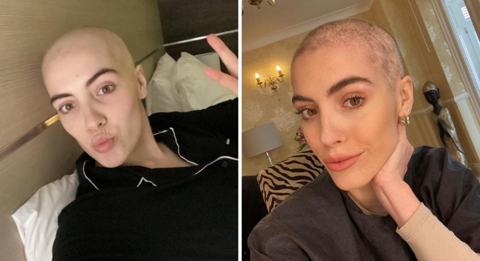 Holden shaved off her hair during chemotherapy. (Cat Holden/SWNS)