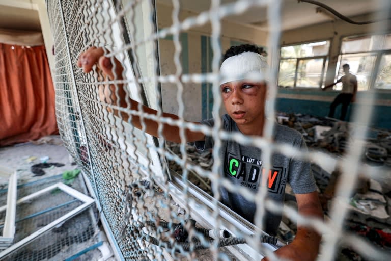 Un niño palestino herido mira a través de una ventana de la escuela de la ONU reconvertida en refugio para desplazados y bombardeada por Israel, en el campamento de Nuseirat, en el centro de la Franja de Gaza, el 7 de junio de 2024 (Eyad Baba)