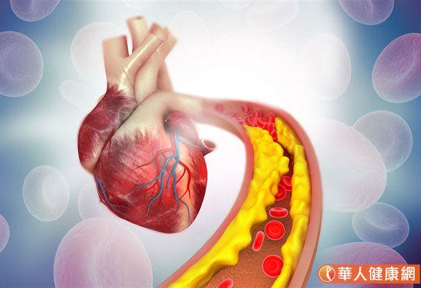 一次搞懂常見5大心臟疾病：高血壓性心臟病、冠狀動脈心臟病、心律不整等