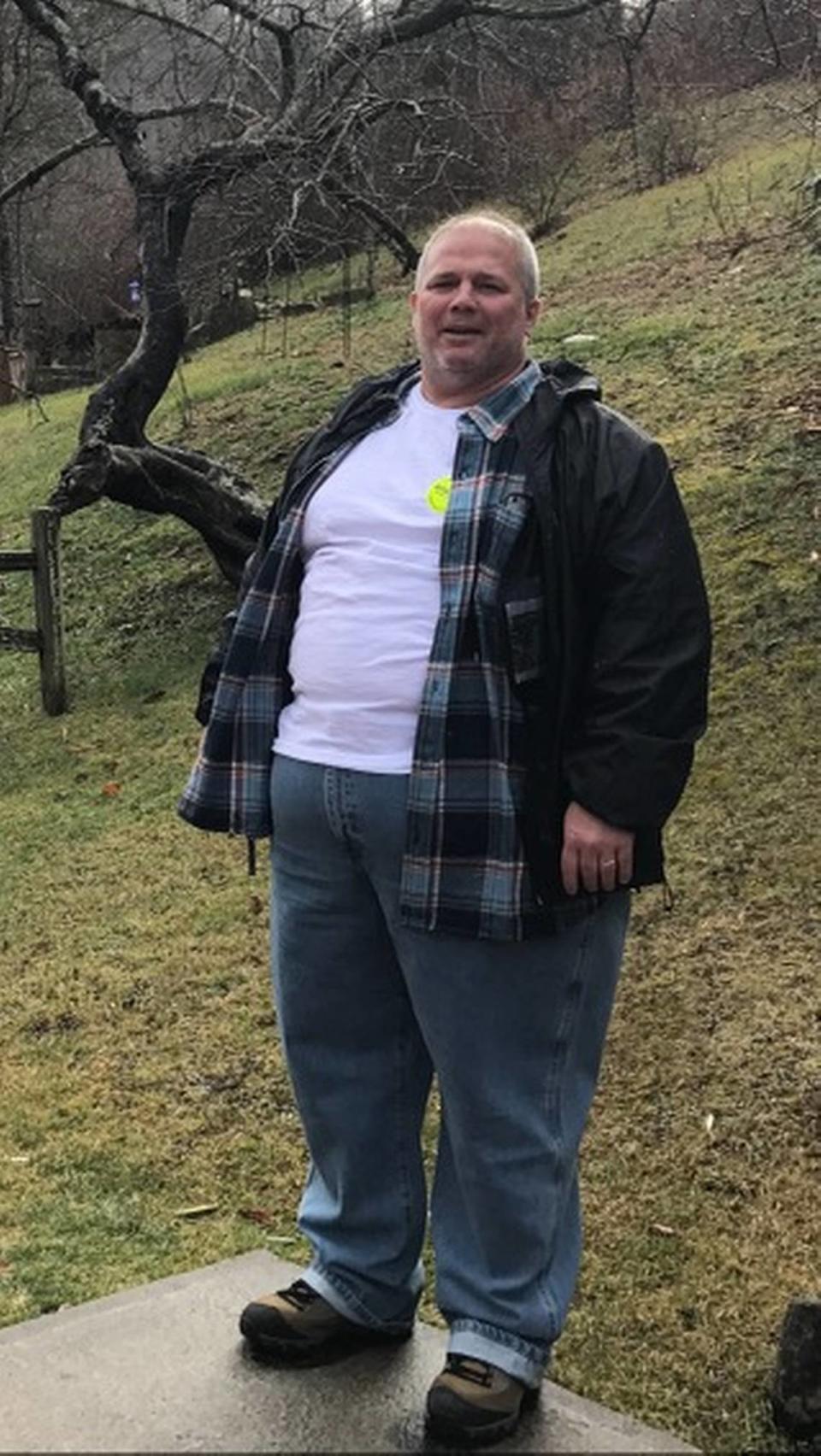 Mario Farnesi at his heaviest weight — 392 pounds, before his bariatric surgery at Jackson Memorial Hospital. After the surgery, he lost more than 150 pounds.