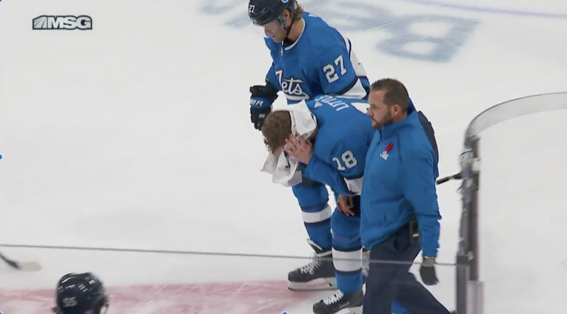 Bryan Little remains in hospital after taking a puck off the head against the Devils on Tuesday. (MSG Network)