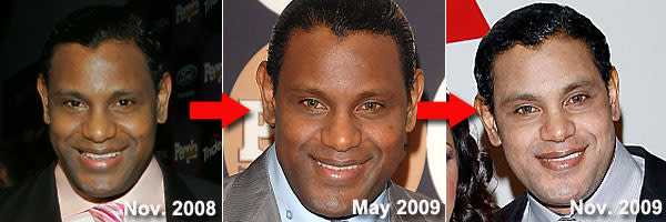 Sammy Sosa Bleaches Skin