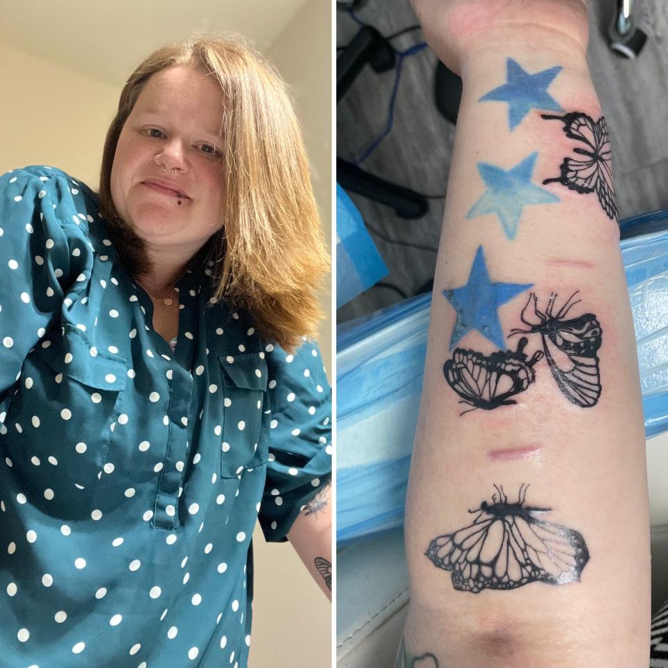 Samantha Warmbrodt and a picture of the medical tattoos on her arm