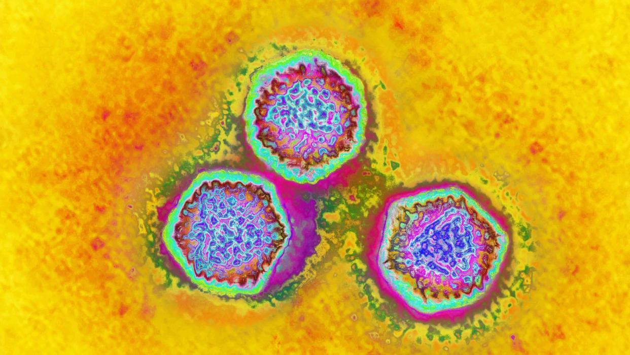  Microscope image shows three circular blobs that are positioned in a triangle orientation. They are multicolored with lots of dots in the center. The background is bright yellow. 