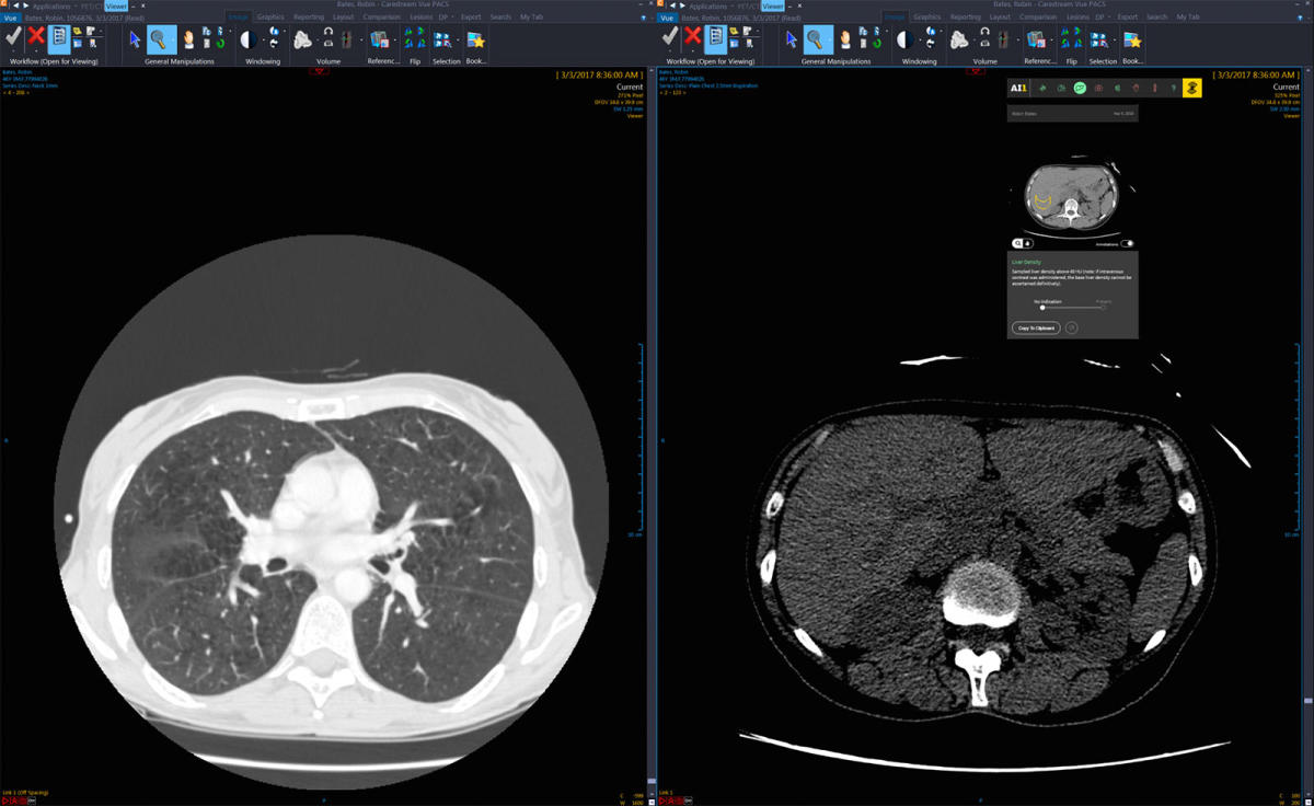 For a dollar, an AI will examine your medical scan