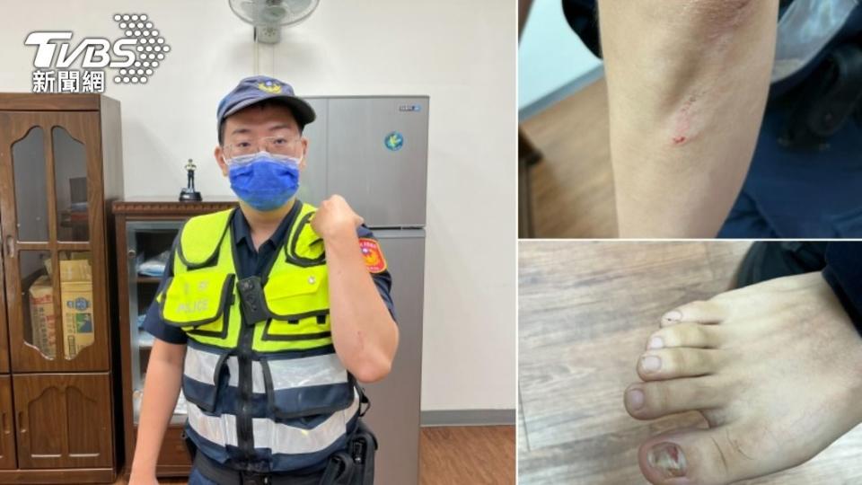 警員黃柏鈞英勇攔車，導致手肘擦傷、大拇指也遭輾傷。（圖／TVBS）