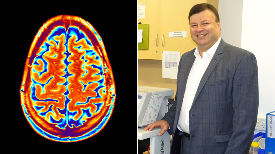 Pictured: Neurosurgeon Stephen Santoreneos and a brain scan. Images: Supplied, Getty