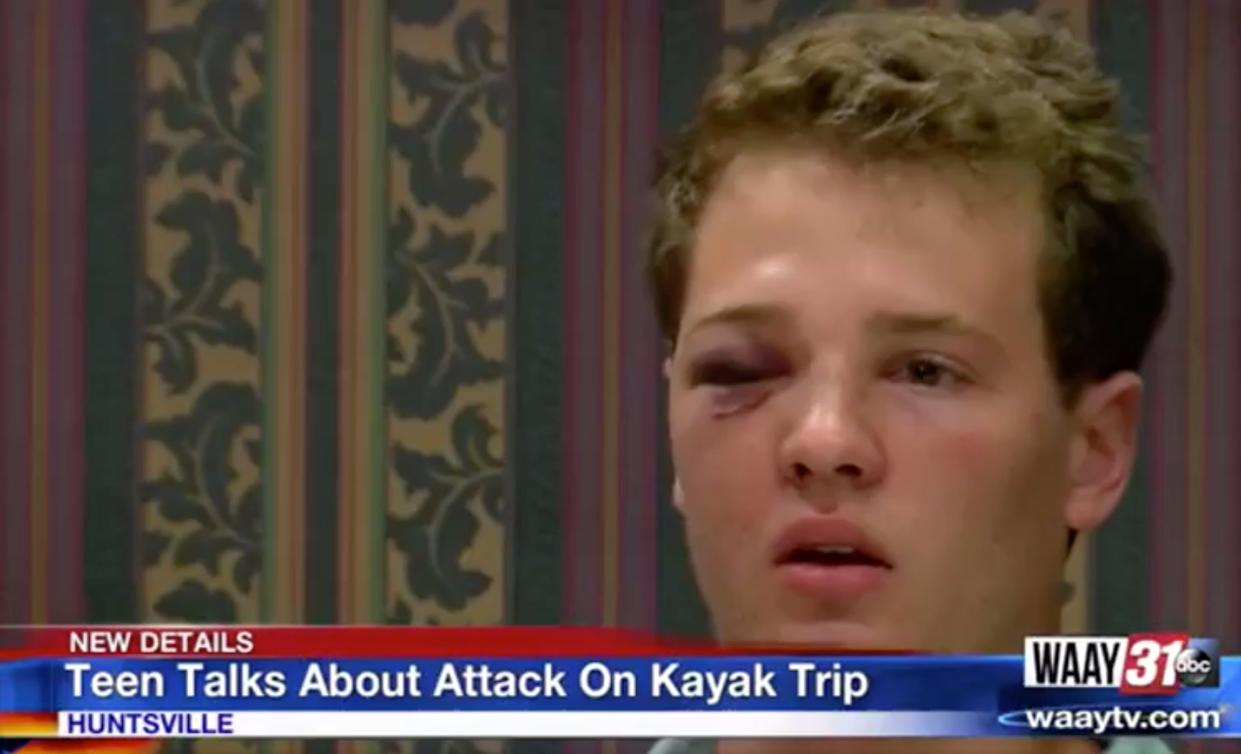 Teens claim they were attacked by a group of adults while floating down the river in Alabama. (Photo: WAAY)