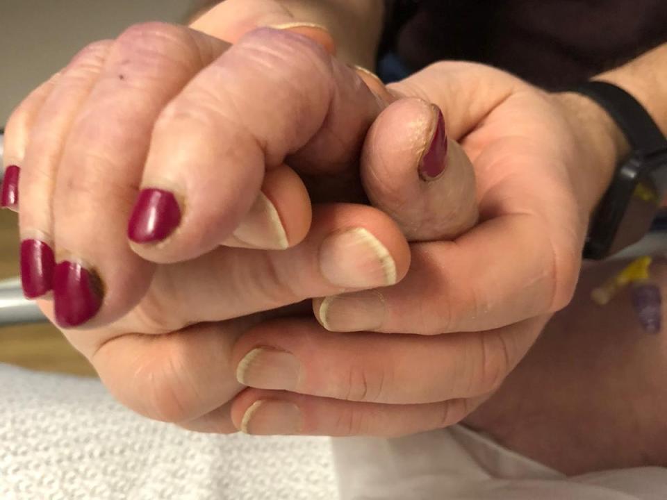 Janet and Thomas Duncan holding hands - the last picture taken before she died. (SWNS)