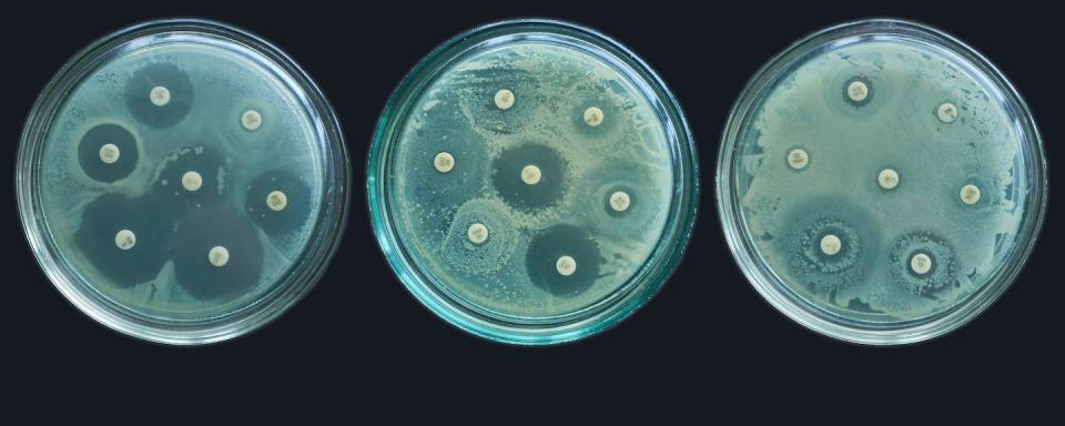 Antimicrobial resistance susceptibility lab tests. (Shutterstock)