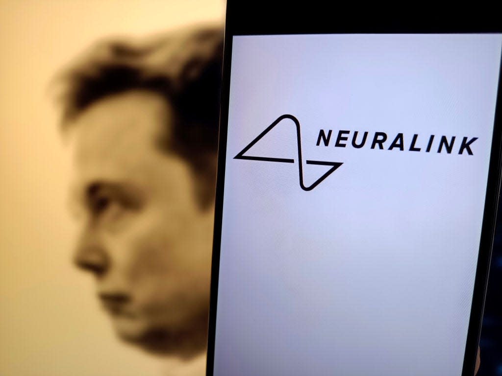 Elon Musk's brain chip startup is preparing to start human trials.