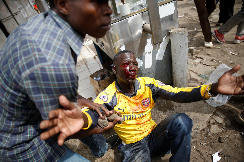 <p>An injured supporter of Kenyan opposition leader Raila Odinga receives assistance in Nairobi, Kenya, Nov. 17, 2017. (Photo: Baz Ratner/Reuters) </p>