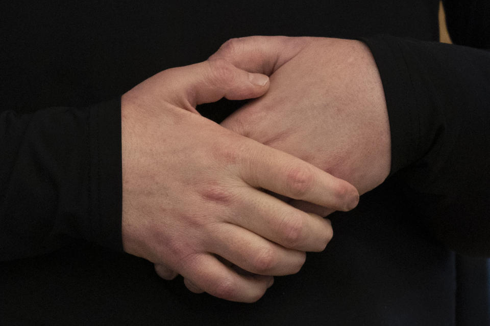 Joe DiMeo clasps his new hands, Jan. 25, 2021 in New York. In the months since his transplant surgery, DiMeo has not shown any signs of rejecting his new face or hands. (AP Photo/Mark Lennihan)