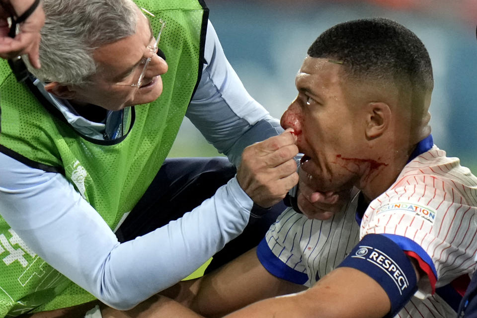 FILE - Kylian Mbappe of France receives a treatment after suffering an injury during a Group D match between Austria and France at the Euro 2024 soccer tournament in Duesseldorf, Germany, on June 17, 2024. Kylian Mbappé has had more masks than goals at Euro 2024. Widely regarded as the heir to Lionel Messi and Cristiano Ronaldo as soccer's biggest icon, the France striker is struggling with his peripheral vision due to the protective face covering he has been fitted with since breaking his nose at the start of the European Championship. (AP Photo/Alessandra Tarantino)