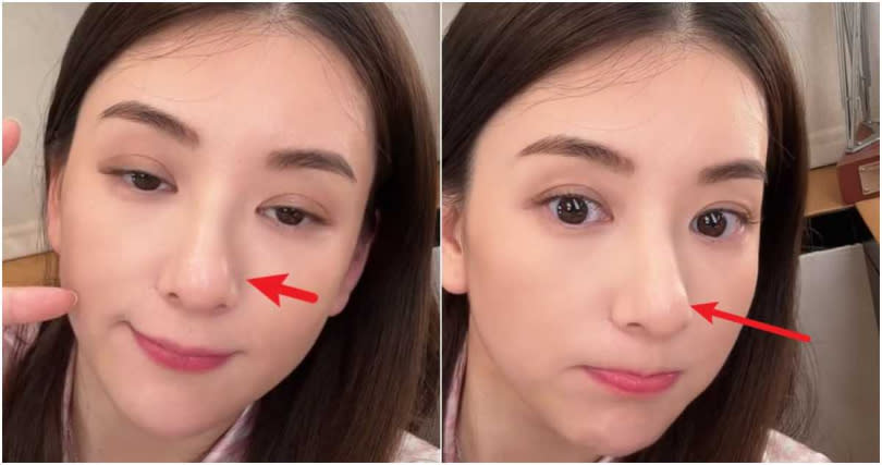 網友發現方媛鼻子有點歪，鼻翼左側似乎有動過刀的痕跡。（圖／翻攝自網易娛樂）