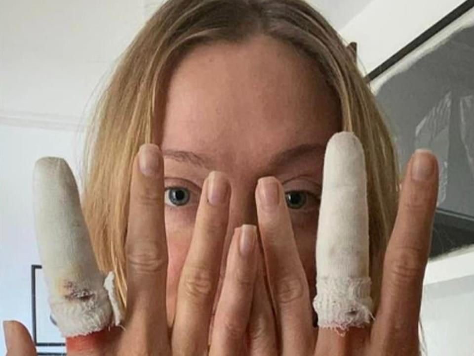 Loulou Taylor, an actor, was bitten by a seal on a South African beach (Instagram)