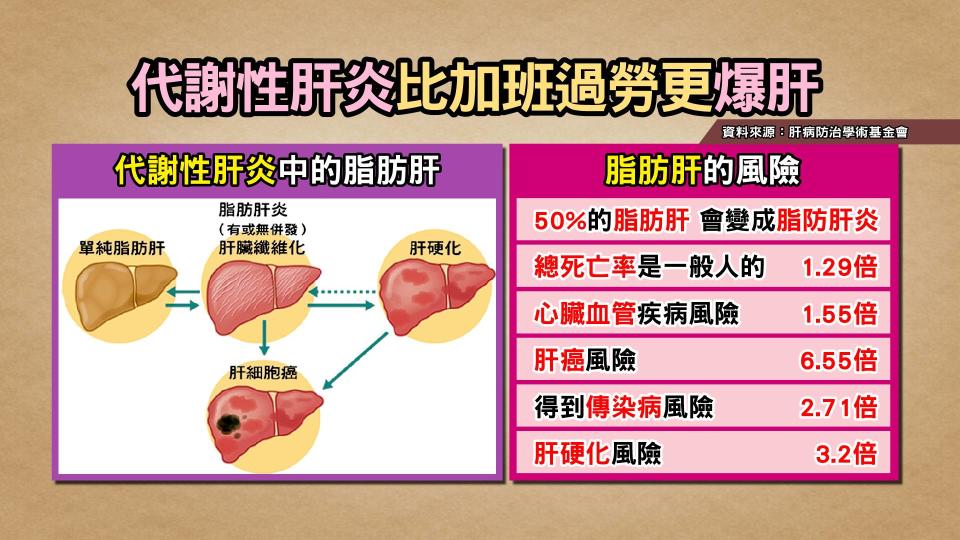 ▲資料顯示約有50%的脂肪肝患者，會進展成脂肪型肝炎。