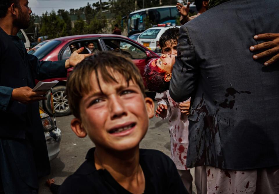 A child cries as another child is cradled by an adult nearby.