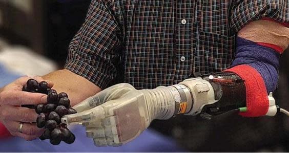 Keven Walgamott, a Utah estate agent who lost his hand and part of his arm 17 years ago in an accident, tests a new prosthetic arm that can move with his thoughts (University of Utah/SWNS)