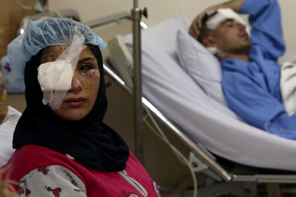 A Lebanese woman, Ghadeer Mortada, 18, who wounded along with three members of her family, lies on a hospital bed next to her husband Hussein, 23, after a deadly car bomb exploded Saturday evening, in the predominately Shiite town of Hermel, about 10 miles (16 kilometers) from the Syrian border in northeast Lebanon, Sunday, Feb. 2, 2014. A shadowy Lebanese Sunni extremist group late Saturday claimed responsibility for a suicide car bombing in Hermel, a stronghold of Lebanon's Shiite militant Hezbollah group, that killed several people in the latest attack linked to the war in neighboring Syria. (AP Photo/Hussein Malla)