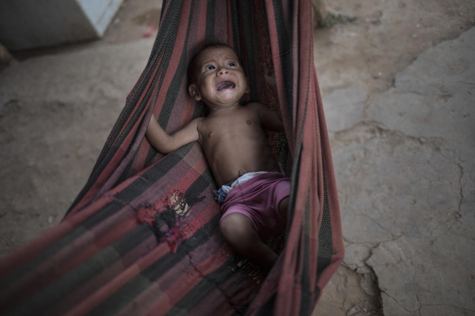 Malnourished Osmery Vargas cries in a hammock as she and her 7-year-old sister Yasmery Vargas wait for their mother to return from begging in the street for money and food, in Maracaibo, Venezuela, Nov. 25, 2019. Opposition leader Juan Guaidó this year launched a campaign promising to oust President Nicolás Maduro and return the nation to its bygone prosperity, but while the power struggle plays out, millions of Venezuelans remain caught in the middle. (AP Photo/Rodrigo Abd)