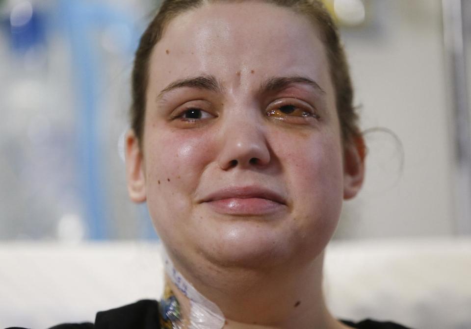 Washington mudslide survivor Amanda Skorjanc, 25, talks to the media while sitting in her hospital bed on Wednesday, April 9, 2014, in Seattle. On March 22, Skorjanic said she was trapped in a pocket formed by her broken couch and pieces of her roof. Skorjanic said that she remembers hearing the voices of several men coming to her aid, she had two broken legs and a broken arm. (AP Photo/The Herald, Dan Bates, Pool)