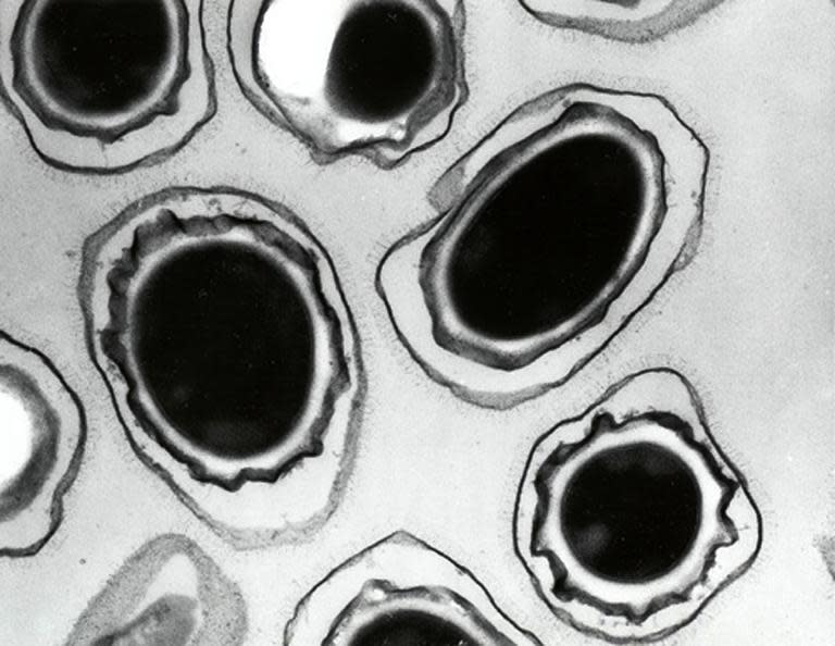 This undated image released by the US Department of Defense official web site, Anthrax Vaccine Immunization Program, shows Bacillus anthrax spores