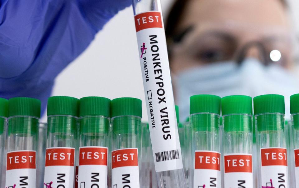 Test tubes labelled "Monkeypox virus positive" - REUTERS/Dado Ruvic/Illustration/File Photo