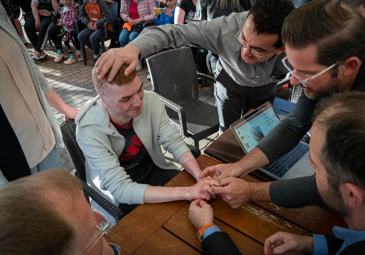 Dr. David Brown, a plastic surgeon from the University of Michigan, left, helps to screen Volodymyr Bubela, 17, of Lviv, Ukraine Sunday, May 14, 2023 on a hotel patio in Leczna, Poland. Brown was joined with Doctors Collaborating to Help Children Founder Dr. Gennadiy Fuzaylov, Dr. Shawn Diamond an Assistant Professor of Plastic Surgery at Texas Tech in El Paso and Dr. Brian Kelley, a plastic surgeon at the University of Texas at Austin Dell Medical School. Bubela was severely burned at the age of 7 in a barn fire and will have his hands operated on.  
