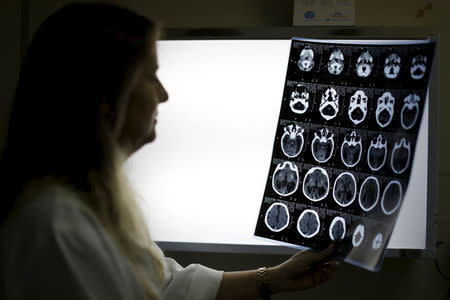 Child Neurologist Vanessa Van Der Linden observes the X-ray of a baby's skull with microcephaly at the hospital Barao de Lucena in Recife, Brazil, January 26, 2016. REUTERS/Ueslei Marcelino