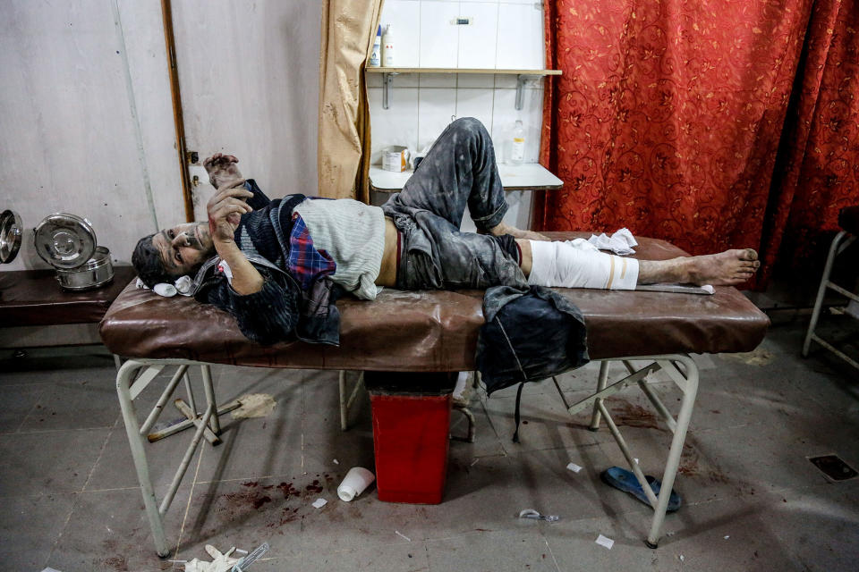<p>A Syrian wounded man waits to receive medical treatment at a hospital after war planes belonging to Assad regime carried out airstrikes over Kfar Batna suburb of Eastern Ghouta in Damascus, Syria on Feb. 6, 2018. (Photo: Khaled Akasha/Anadolu Agency/Getty Images) </p>