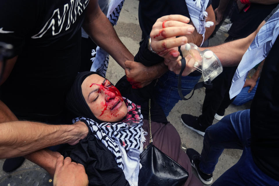 Protesters carry an injured woman during a demonstration, in solidarity with the Palestinian people in Gaza, near the U.S. Embassy in Aukar, a northern suburb of Beirut, Lebanon, Wednesday, Oct. 18, 2023. Hundreds of angry protesters are clashing with Lebanese security forces in the Lebanese suburb Aukar near the United States Embassy. (AP Photo/Bilal Hussein)