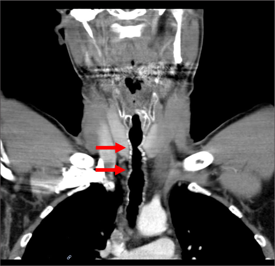 A scan reveals the location of the strange patch of hair. American Journal of Case Reports