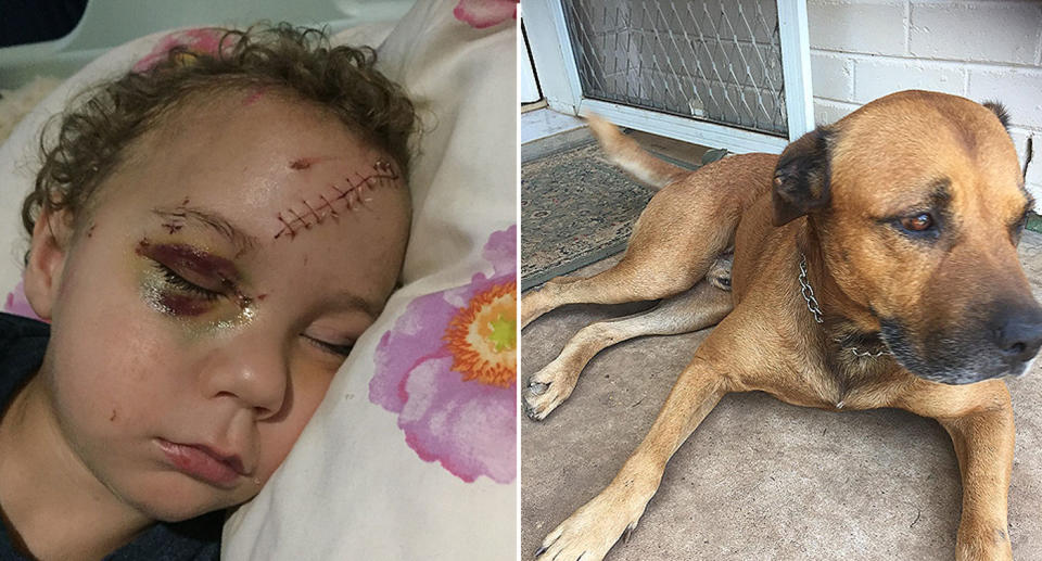 Logan Grieve, 2, was playing in the backyard of his family home in Katherine, Northern Territory, when he was mauled by his family’s Bull Mastiff cross (right). Source: Supplied/ Shannon Coutts