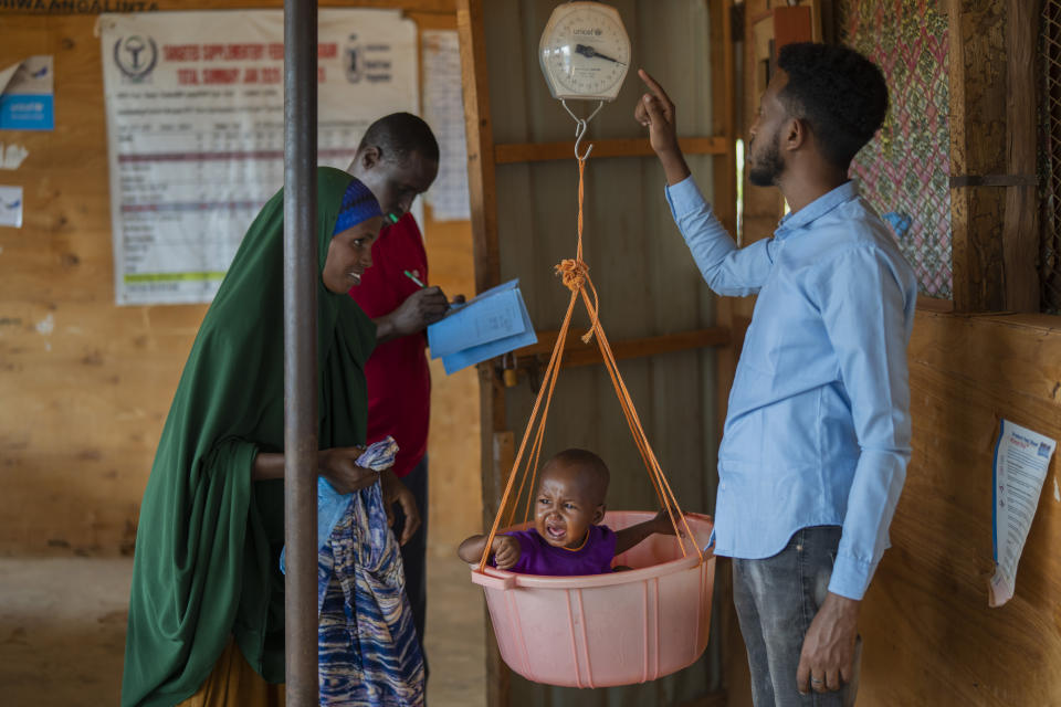 A child is weighed at a camp for displaced people on the outskirts of Dollow, Somalia, on Monday, Sept. 19, 2022. Somalia is in the midst of the worst drought anyone there can remember. A rare famine declaration could be made within weeks. Climate change and fallout from the war in Ukraine are in part to blame. (AP Photo/Jerome Delay)