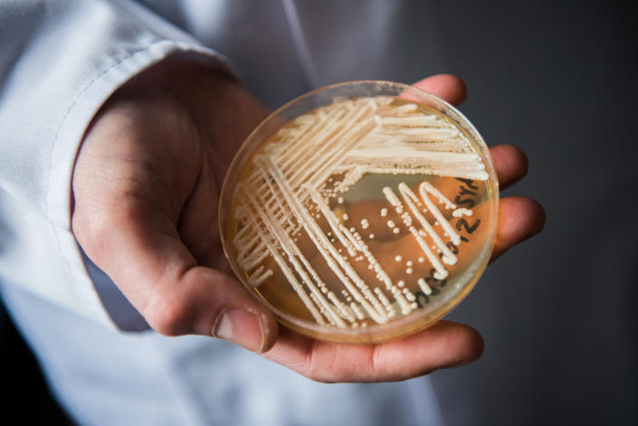 Petri dish of candida auris in a laboratory in Wuerzburg, Germany (Nicolas Armer / picture alliance via Getty Images file )