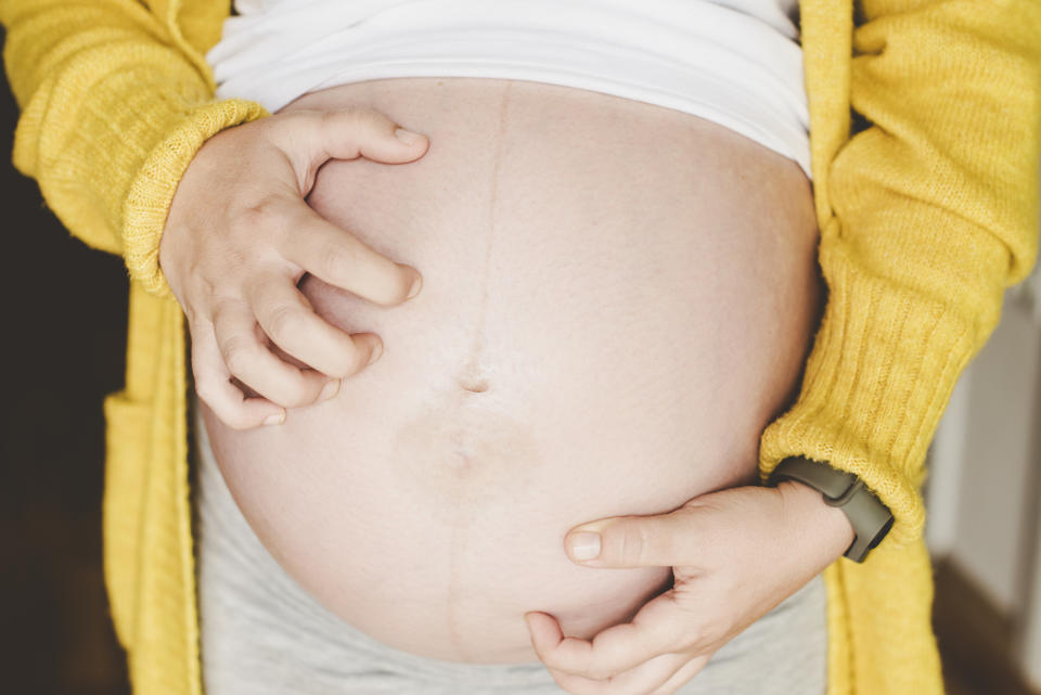The main symptom of cholestasis is itching. (Getty Images)