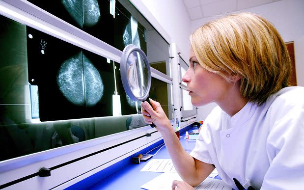 Although the pill slightly raise the risk of breast cancer, the increase vanished quickly after women stopped taking it - Credit: Rex/Shutterstock