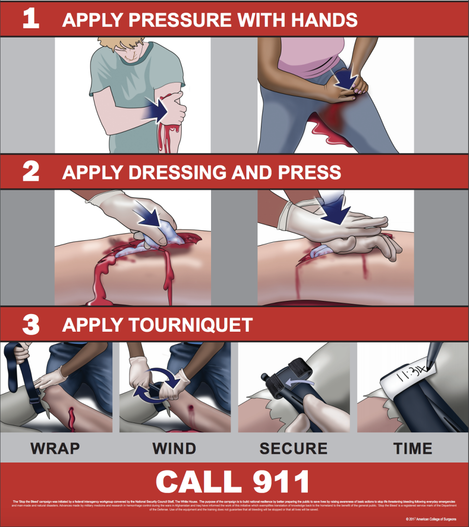 A Stop the Bleed poster. (Image: American College of Surgeons)