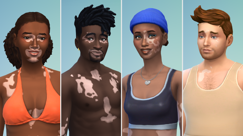the sims 4 vitiligo skin update