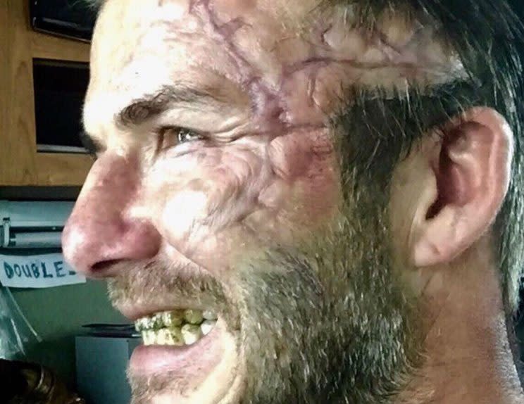 Scars… Beckham shows off horrific make-up for King Arthur movie – Credit: Instagram