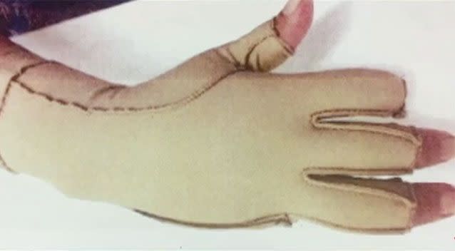 Parts of Ms Afamiliona's fingers were cut off. Source: 7 News