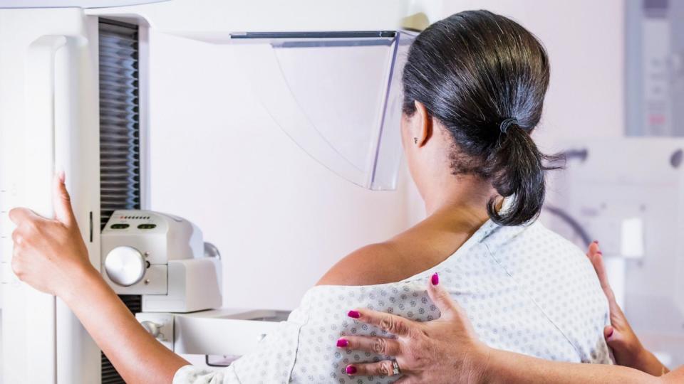 PHOTO: In this undated stock photo, a woman is seen gettin a mammogram.  (STOCK PHOTO/Getty Images)