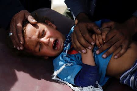 A displaced Iraqi boy who was injured during clashes between Iraqi forces and Islamic State militants is treated near a frontline in western Mosul, Iraq, May 16, 2017. REUTERS/Danish Siddiqui