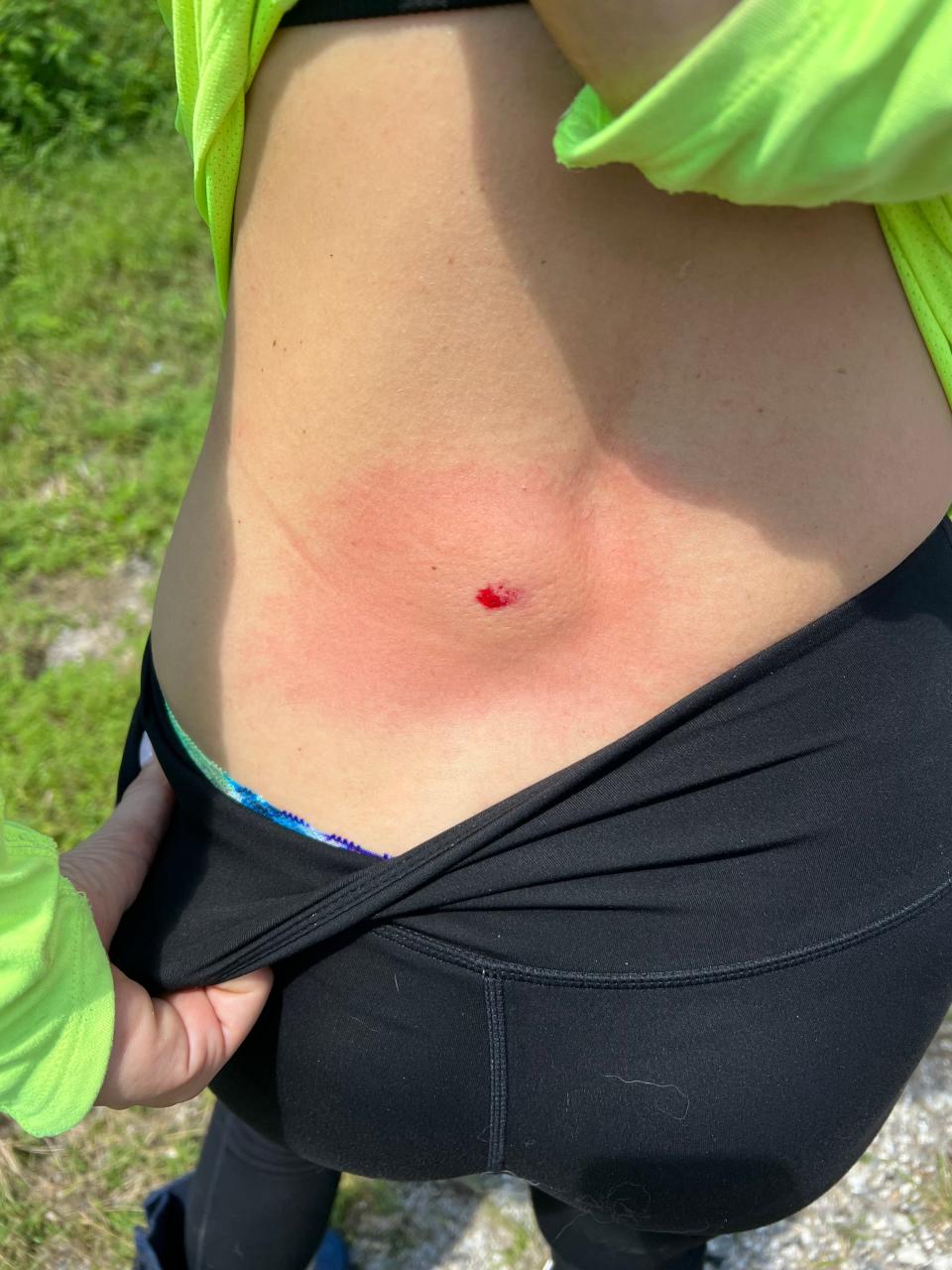 Nicole Adams was hit by a bullet while she worked at her stables near her home west of Lake Worth Beach, Florida. The sheriff's office determined that the stray bullet that struck Adams on September 10, came from Joe's Nursery where people were shooting at targets next to her property.