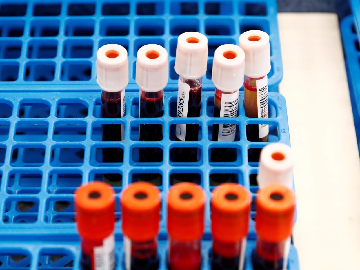 Tubes with blood samples are seen at the Belgian Red Cross blood collection centre during the coronavirus pandemic (REUTERS/Francois Lenoir)